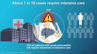 Management and Treatment of Acute Pancreatitis [upl. by Louie]