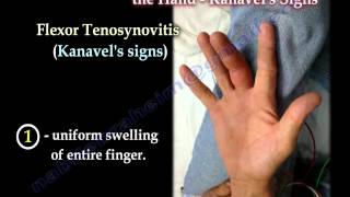 Flexor Tenosynovitis Of The Hand Kanavels Signs  Everything You Need To Know  Dr Nabil Ebraheim [upl. by Ariahs]