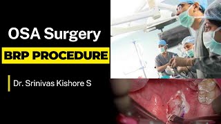 Advanced Barbed Reposition Pharyngoplasty BRP for Severe OSA  StepbyStep Surgical Procedure [upl. by Zimmer]