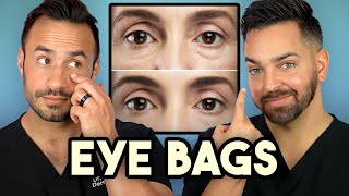 How Treat Under Eye Bags Like A Dermatologist [upl. by Nohsram]