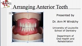 Video 17  C D Arrangement of the Anterior Teeth  Lecture [upl. by Lehcem657]