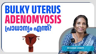 Adenomyosis  Is it problematic  Bulky uterus ADENOMYOSIS പ്രാധാന്യം എന്ത്  DRSUSAN JOSEPH [upl. by Nessa]