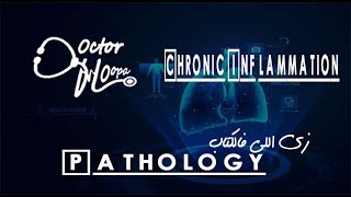 CHRONIC INFLAMMATION GRANULOMA  Doctor HOopa  Pathology زي اللي فالكتاب [upl. by Eizzik]