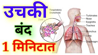 उचकी लागणे बंद करा फक्त 1 मिनिटात Hiccups home remedies in Marathi [upl. by Nnomae]