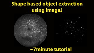 Shape Based Object Extraction in ImageJ or Fiji [upl. by Marla]