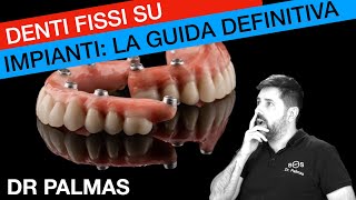 Tutto quello che hai sempre voluto sapere sugli impianti dentali [upl. by Roman956]