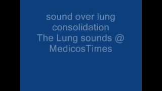 sound over lung consolidation [upl. by Gonyea]