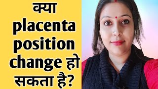 Can Placenta position be changedक्या प्लेसेंटा पोजीशन बदल सकता है twinsmyworld placentaposition [upl. by Maitund305]