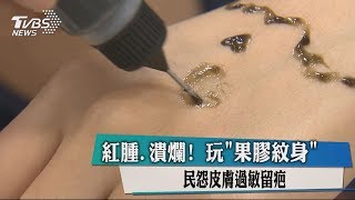 紅腫、潰爛！ 玩「果膠紋身」 民怨皮膚過敏留疤 [upl. by Fredrika]