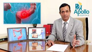 Colonoscopy Sigmoidoscopy in Hindi Dr Shravan Bohra liver specialistApolloAhmedabad [upl. by Leila]