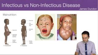 Infectious vs NonInfectious Disease [upl. by Boudreaux]