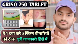 Griso 250 tablet uses dose benefits and Side effects full review in hindi [upl. by Esekram]