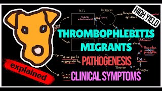 Thrombophlebitis migrants Trousseau syndrome Pathogenesis Symptoms Treatment [upl. by Osi]