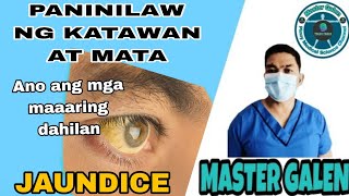 Jaundice paninilaw ng katawan at mata anong dahilan [upl. by Arama982]