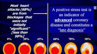 What Does Your Stress Test Really Mean  The Princeton Longevity Center [upl. by Louth314]