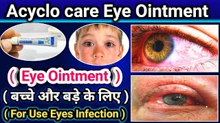 Acyclo care eye Ointment  Aciclovir Ointment use for eye infection kids amp Adult  Full Review [upl. by Warthman]