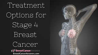 What Are the Treatment Options for Stage 4 Breast Cancer [upl. by Ditter967]