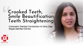 Teeth Correction and Straightening without Braces  Cosmetic Dental Treatment Review [upl. by Adniral]