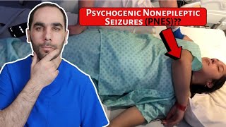 What are Psychogenic Nonepileptic Seizures PNES [upl. by Atirat]