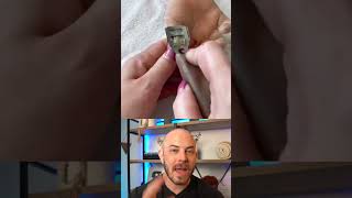 Doctor explains this INSANE form of keratoderma dermreacts doctorreacts keratoderma [upl. by Rodolphe209]