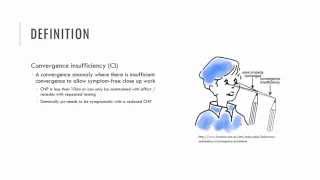 Convergence Insufficiency Characteristics [upl. by Ansaev836]