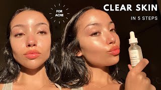 MY UPDATED SKINCARE ROUTINE  unsponsored skincare for acne [upl. by Perseus]