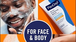 Clear Your Acne amp Blemishes PanOxyl Acne Face Wash Honest Review Clear Your Skin With This Product [upl. by O'Gowan204]