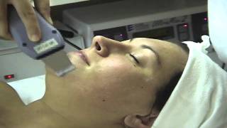 Ultrasonic Facial Demonstration [upl. by Mir]