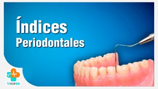 Índices Periodontales  Tu Salud Guía [upl. by Airretal521]