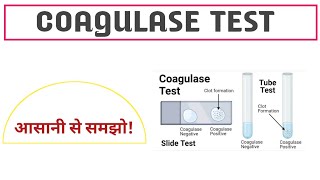 Coagulase Test ll Purpose ll Principle ll Procedure ll result ll in hindi ll [upl. by Yenettirb]