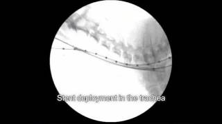 Veterinary Bronchoscopy584 Tracheal Stent Placement for Primary Tracheal Collapse in dog [upl. by Anauqes]