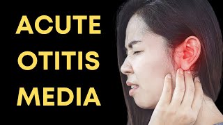 Acute Otitis Media Pop Quiz [upl. by Andria806]