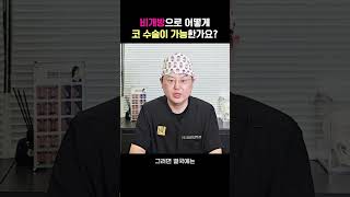 비개방으로 어떻게 코 수술이 가능한가요 코성형 비개방코성형 코재수술 노즈랩의원 이너개방코성형 [upl. by Marsiella]