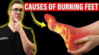 Top 11 Causes of Burning Feet amp Peripheral Neuropathy Instant FIX [upl. by Anirat]