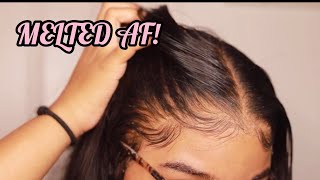 How to RE Install Frontal Wigs for Beginners  VERY DETAILED  Melt Transparent Lace [upl. by Aiuqram]