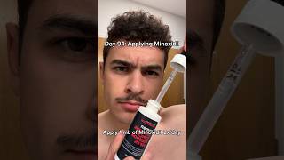 Minoxidil for MAX Beard Growth [upl. by Ahsitam]