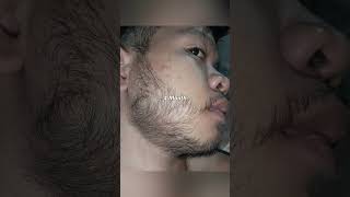 Kirkland Minoxidil Beard Journey 4 MONTH TRANSFORMATION [upl. by Cinomod]