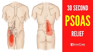 How to Fix a Tight Psoas Muscle in 30 SECONDS [upl. by Savihc44]