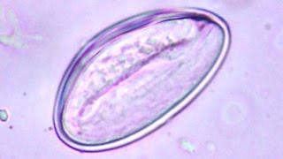 SCARY Moving human pinworm  movement inside the egg  Enterobius vermicularis [upl. by Bryana]