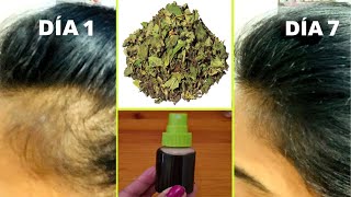 Recupera cabello de LAS SIENES y zonas despobladas con esta receta💪🟢Cabello fortalecido y sin caída [upl. by Caesar34]