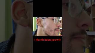 1 month beard growth by minoxidil updatebeard minoxidil beardgrowth [upl. by Annovad]