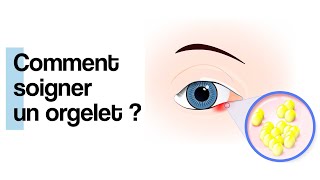 Comment soigner un orgelet [upl. by Iy]