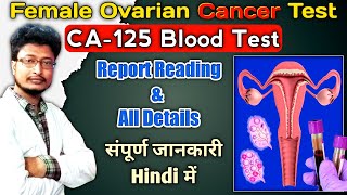 Ovarian Cancer Blood Test  CA 125 Blood Test Kya Hota Hai  How To Read CA125 Test Results [upl. by Greyson998]