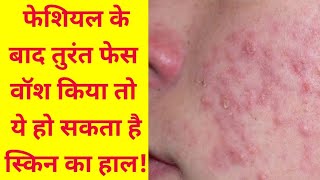 Facial k kitni der baad face wash karna chahiye Facial k baad Face Wash kab karen [upl. by Paff]