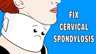 How to fix Cervical Spondylosis Neck Pain in 3 minutes [upl. by Yecaj]