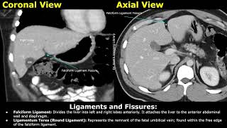 Liver CT Anatomy  Surfaces Lobes Ligaments amp Fissures Porta Hepatis Portal Vein Hepatic Artery [upl. by Aisylla]