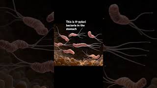 The H pylori bacteria that causes ulcers [upl. by Clarice]