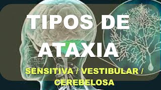 Ataxia Diagnóstico Diferencial Vestibular Sensitivo Cerebeloso [upl. by Carlye266]