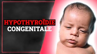 Hypothyroïdie Congénitale Symptômes Causes Traitement  Endocrinologie Medicale [upl. by Auroora]