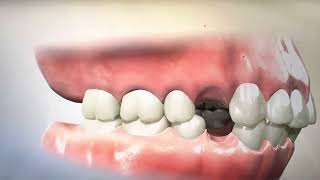 Removing Teeth for Braces  Why Extracting and Retracting Orthodontics is harmful [upl. by Erek]